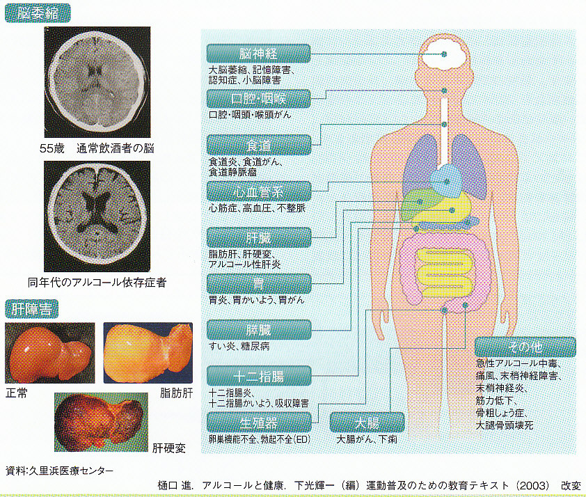 アルコール 依存 新薬 nodsuppo アルコール 依存 新薬 nodsuppo